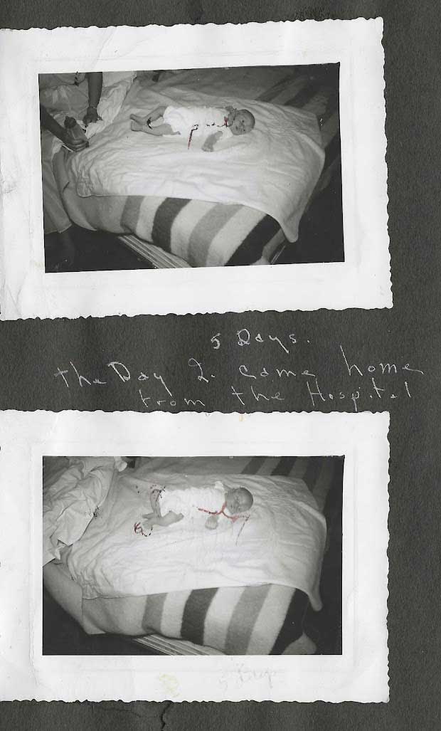 Five Days Old August 1952 Home From the Hospital